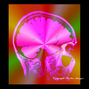 mindscape art gallery image
